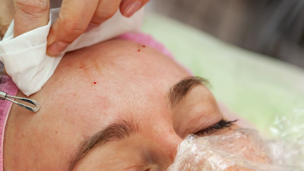 Dermatologo Catanzaro acne