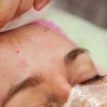 Dermatologo Catanzaro acne
