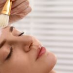 Peeling chimico Catanzaro